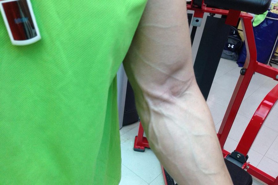 【揭秘】韓國金剛芭比：老公是教練 健身致胸縮水