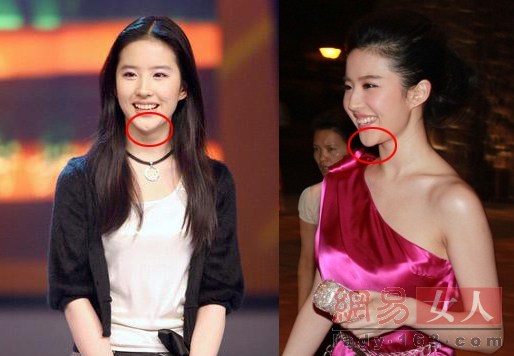 中韓女神也整容 宋慧喬整鼻子劉亦菲翹下巴【組圖】